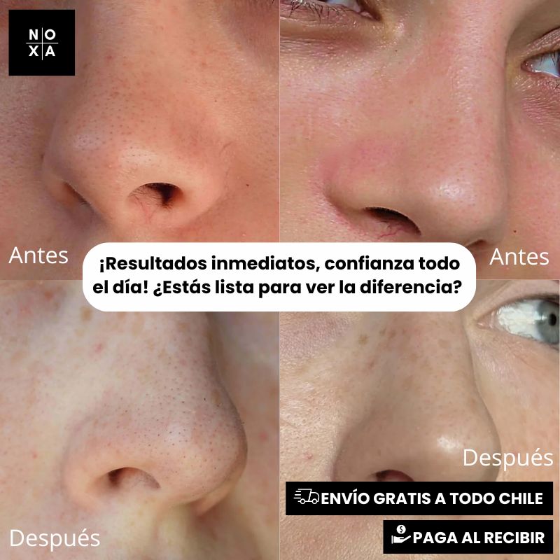 ❤️NoseGlow™ | Parche Limpieza Profunda (12 unidades)