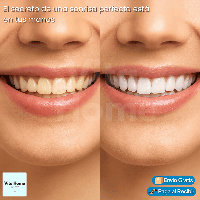 DienteBlanc Instant™ | (2x1) Kit de Blanqueamiento Dental Instantáneo