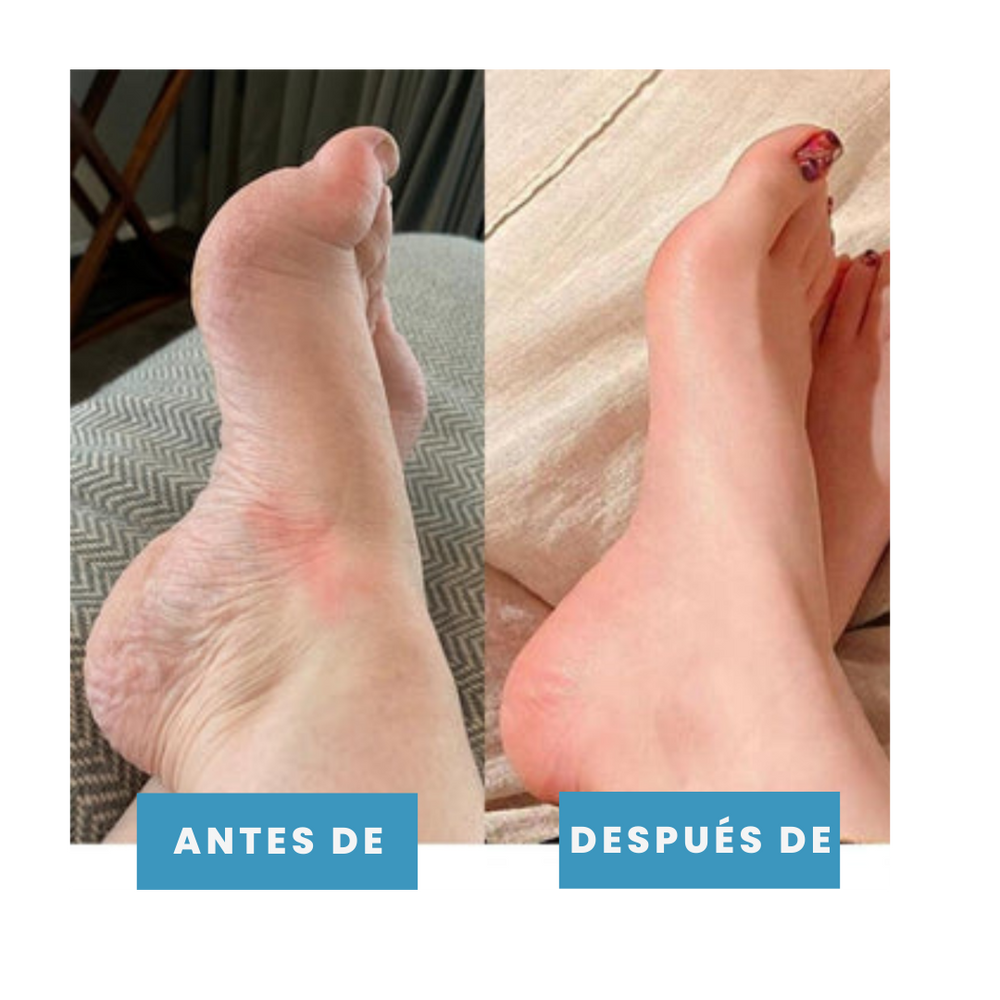 POSTUR™| MASAJEADOR PARA DOLOR DE PIES🧑⚕️