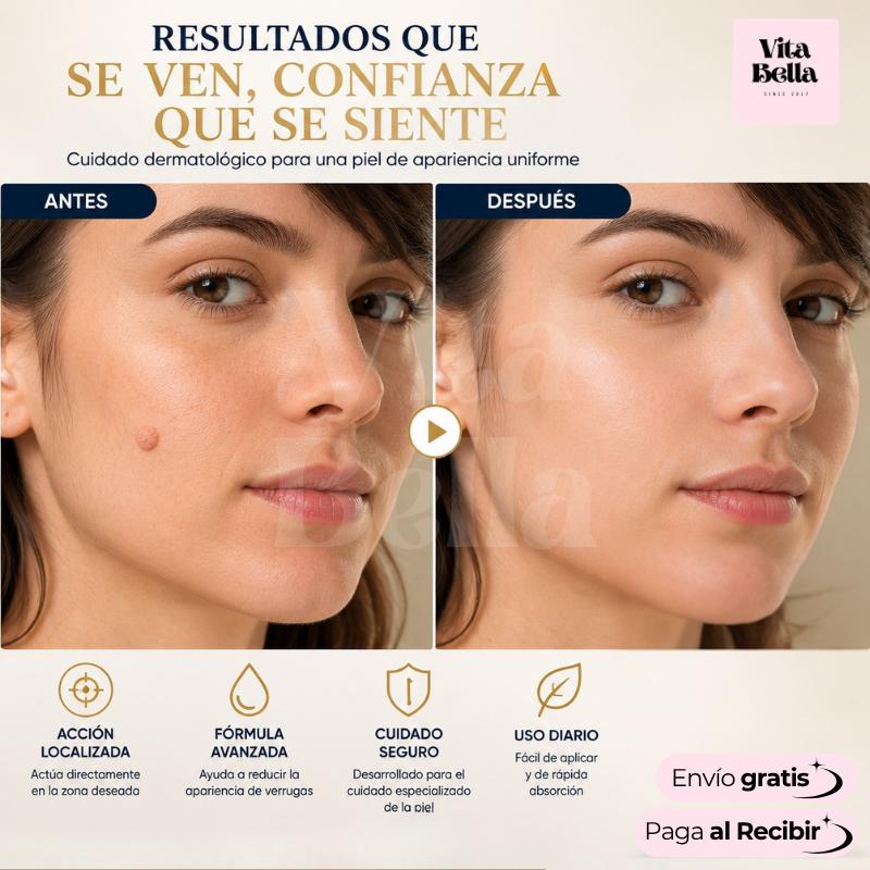 VerruStop™ | Crema Antiverrugas Eficiente