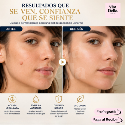 VerruStop™ | Crema Antiverrugas Eficiente