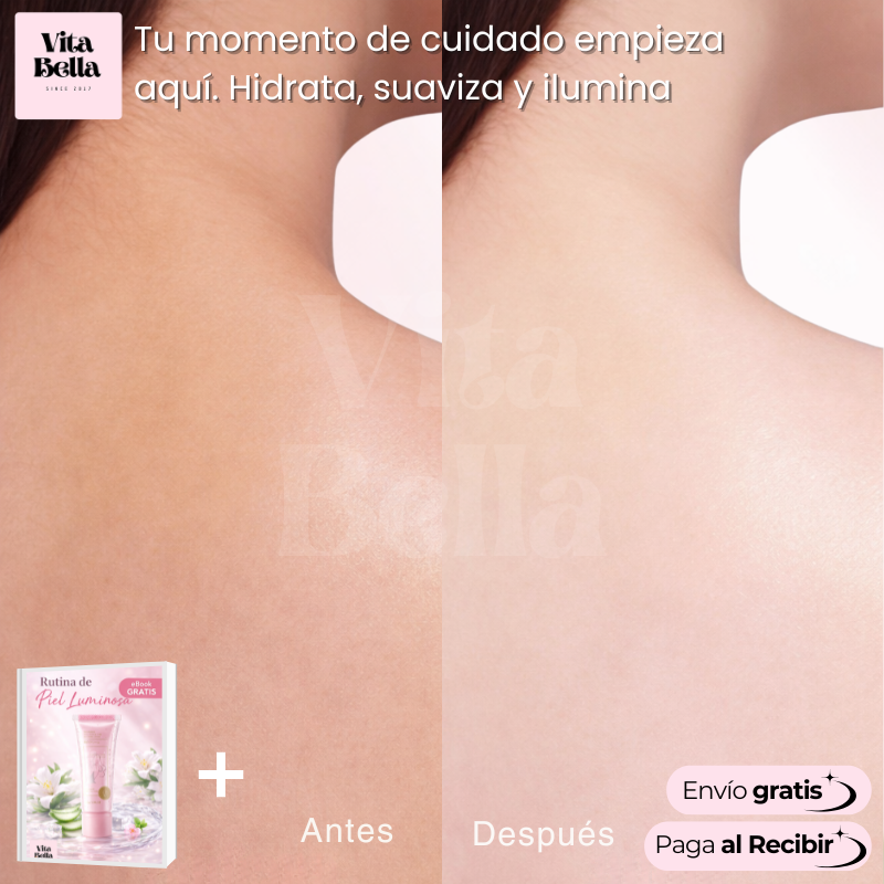 Clariderma™ | Crema Corporal Aclarante con Niacinamida