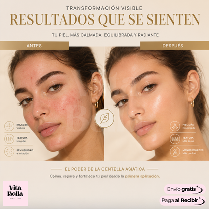 Serumasiatic™ | Serum calmante para piel sensible