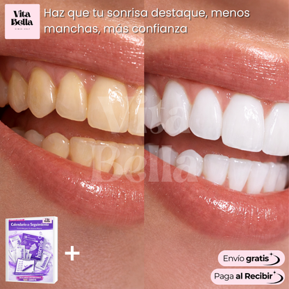 Sonrisa Blanca™ | Tiras blanqueadoras dentales