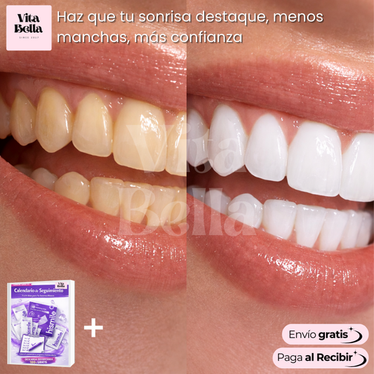 Sonrisa Blanca™ | Tiras blanqueadoras dentales