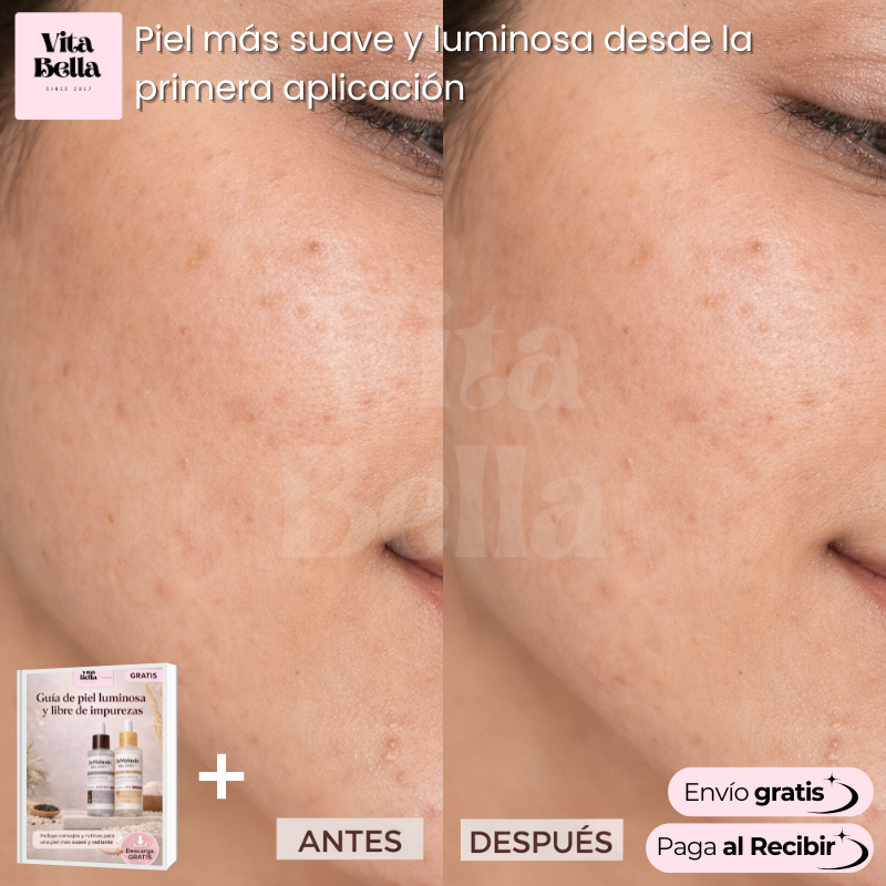 Glow Rice Ampoule™ | Kit Suero facial revitalizante