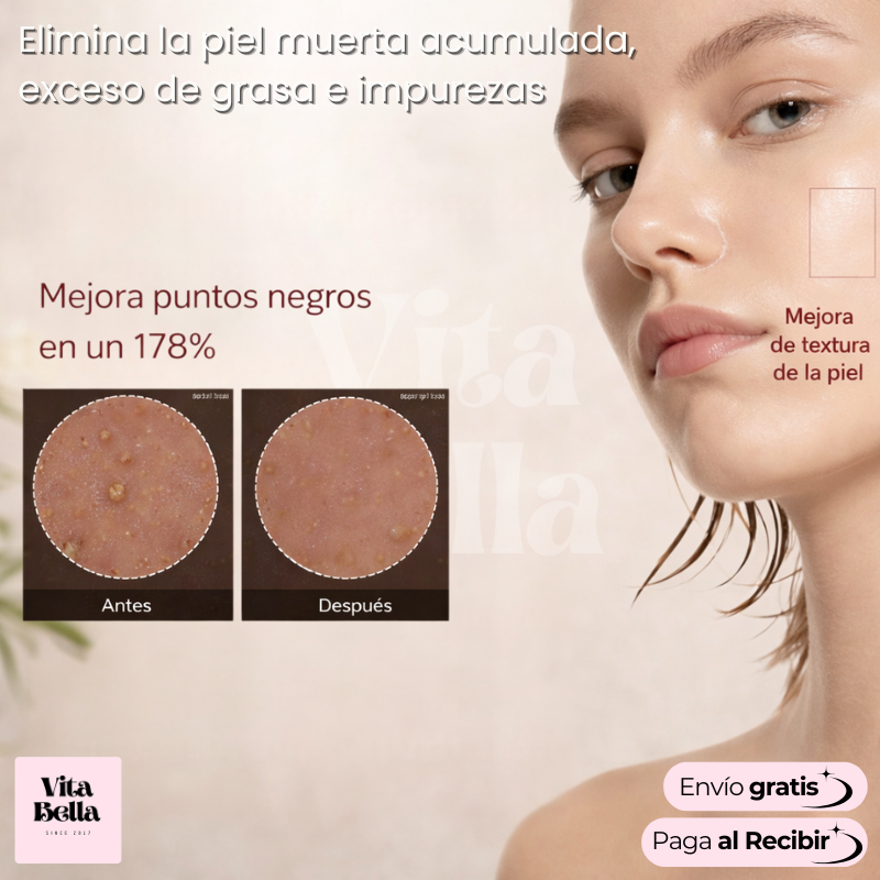 Glow Rice Ampoule™ | Kit Suero facial revitalizante