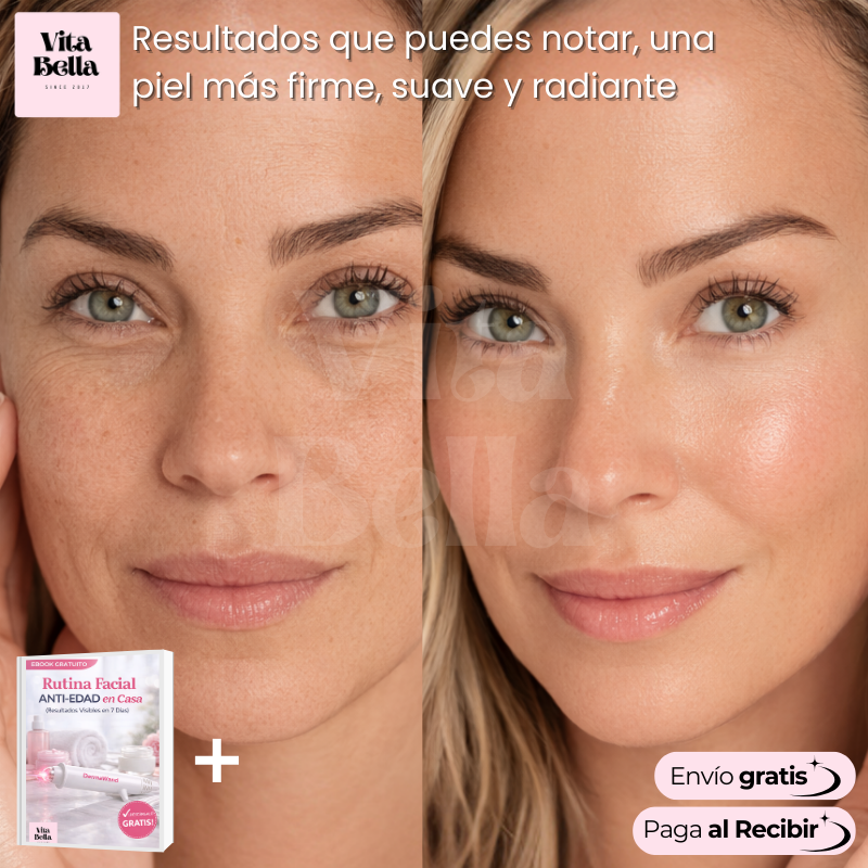 PlasmaSkin™ | Dispositivo de Rejuvenecimiento con Plasma