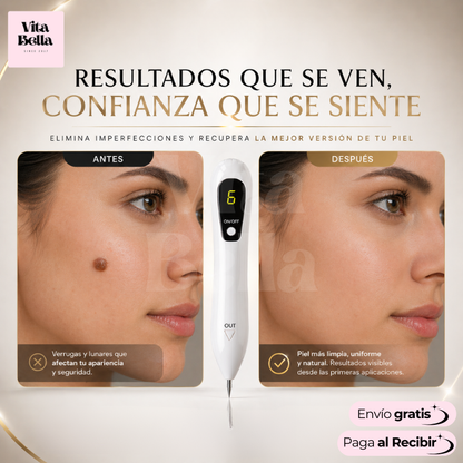 LápizSkinClear™ | Dispositivo para eliminar verrugas y lunares