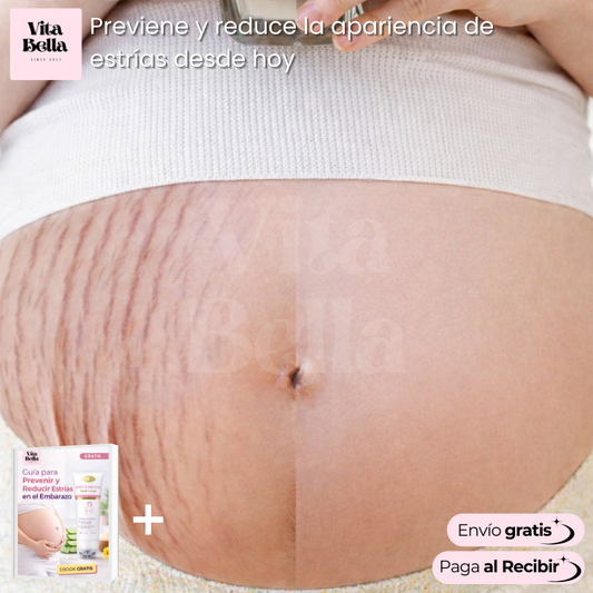 Crema ConfidentSkin™ | Crema antiestrías con masajeador roller