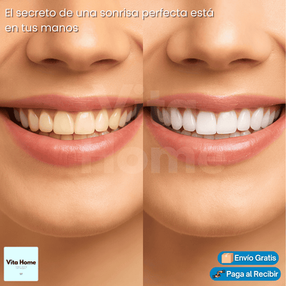 DienteBlanc Instant™ | (2x1) Kit de Blanqueamiento Dental Instantáneo