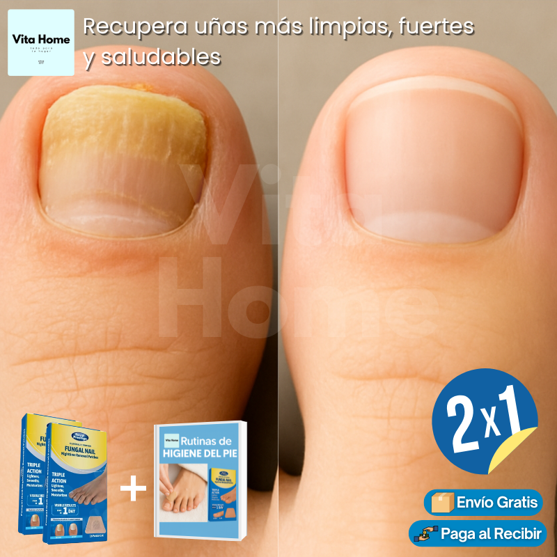 AzulHongo™ | (2x1) Protector de uñas y eliminador de hongos